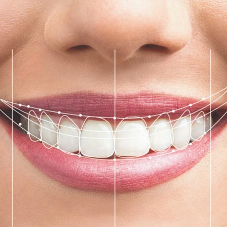 Digital smile designing using